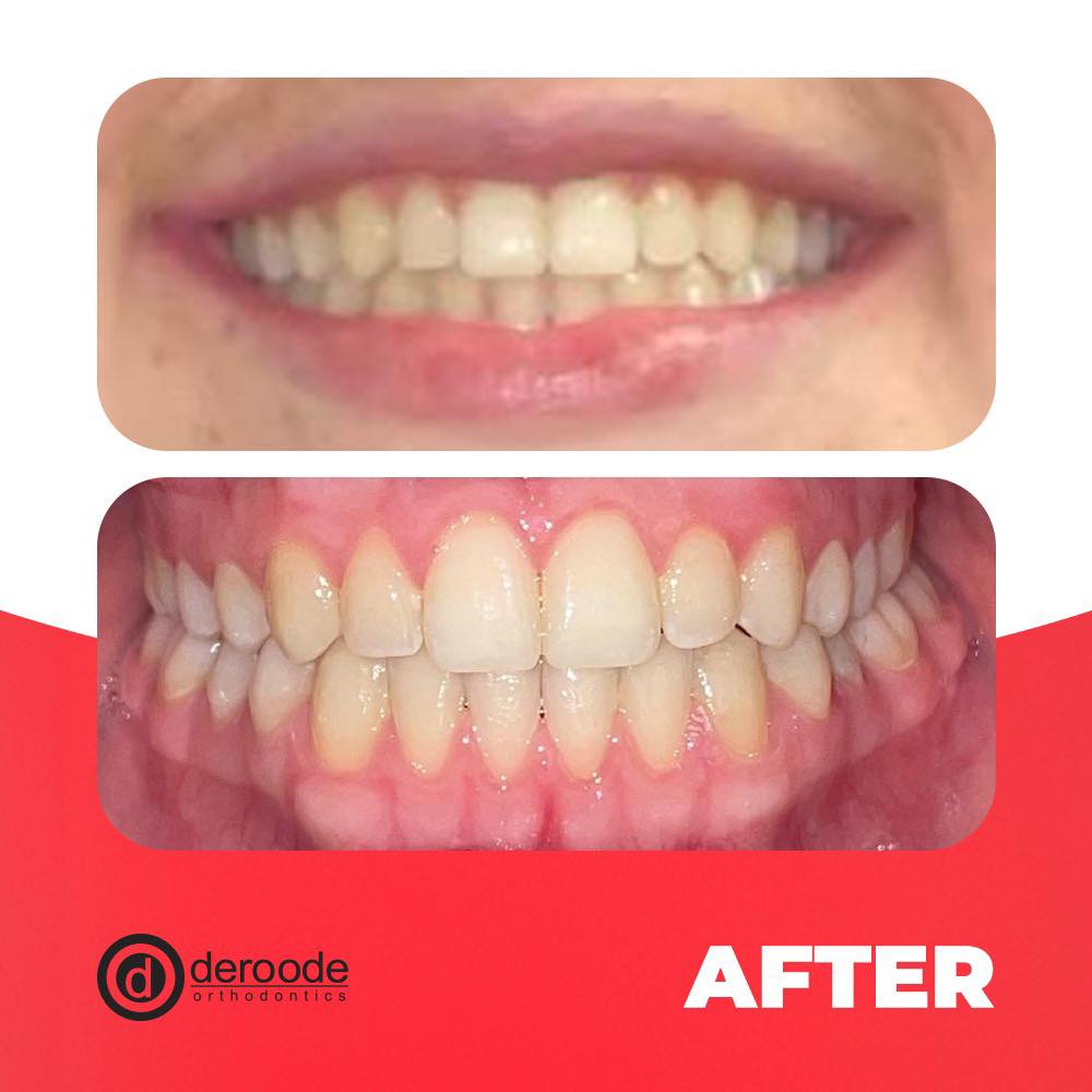 DeRoode Orthodontics | Miami FL