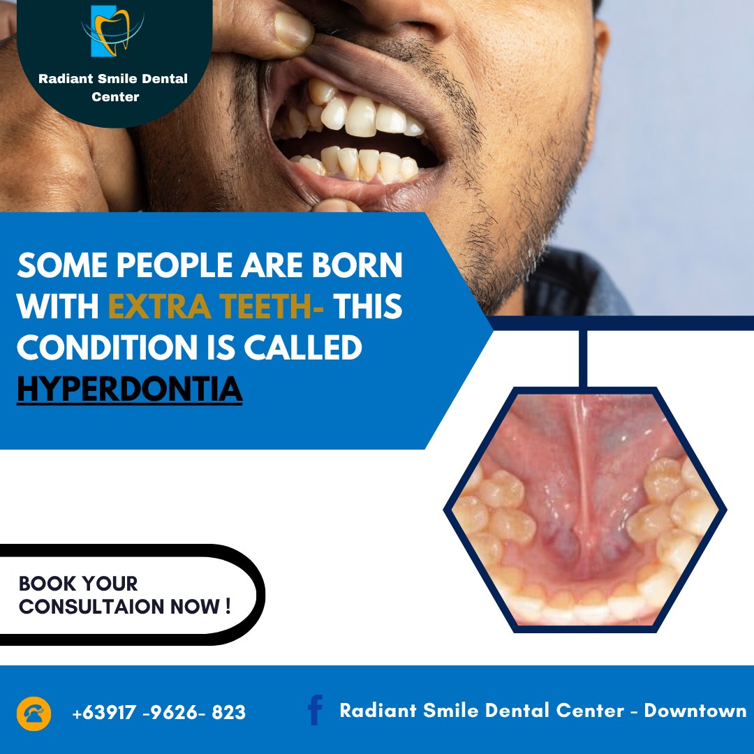 Radiant - 🦷 DID YOU KNOW? Some people are born with extra teeth — a ...