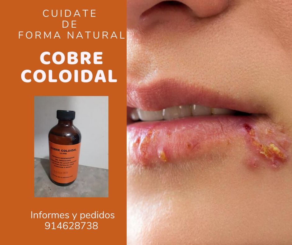 EL COBRE COLOIDAL SE USA PARA :... - Inmunologia Natural | Facebook