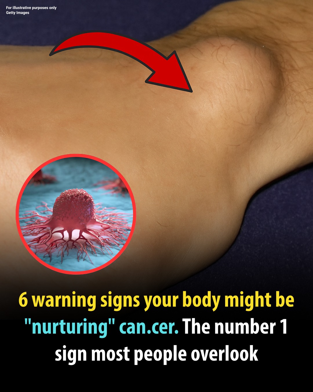 Daily - 6 Common Signs That Warn You May Have C.an.cer That Are Easily ...