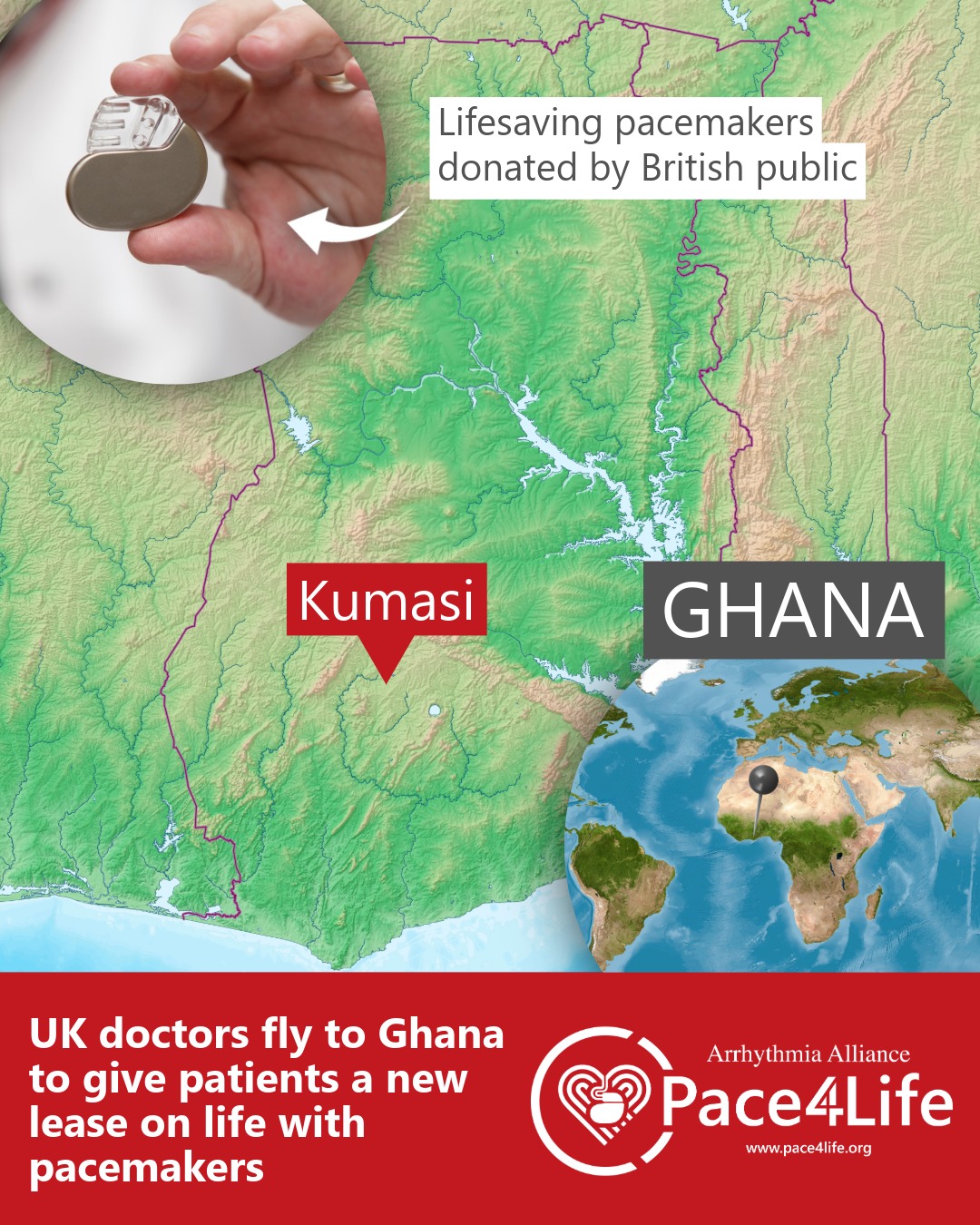 🌍 A team from Northampton General... - Arrhythmia Alliance | Facebook
