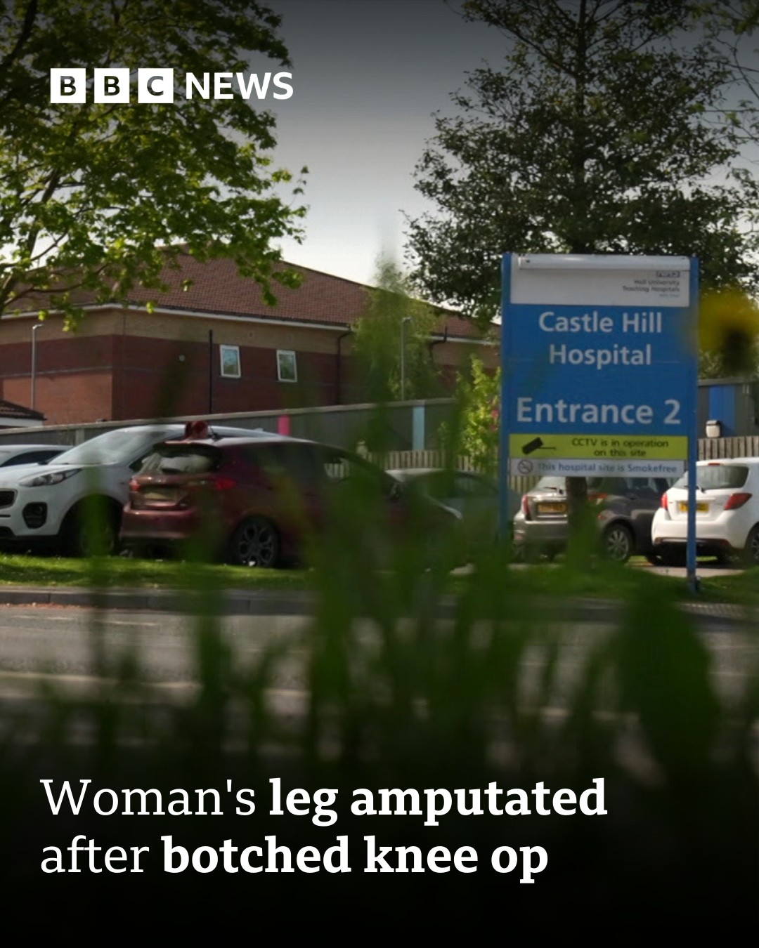Woman wins compensation after botched... - BBC East Yorkshire | Facebook