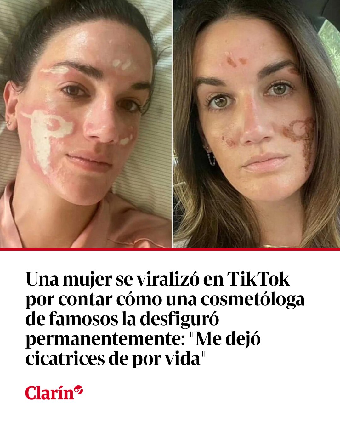 Clarín - 👉 https://clar.in/3LkPGTH | Victoria Nelson denunció ...