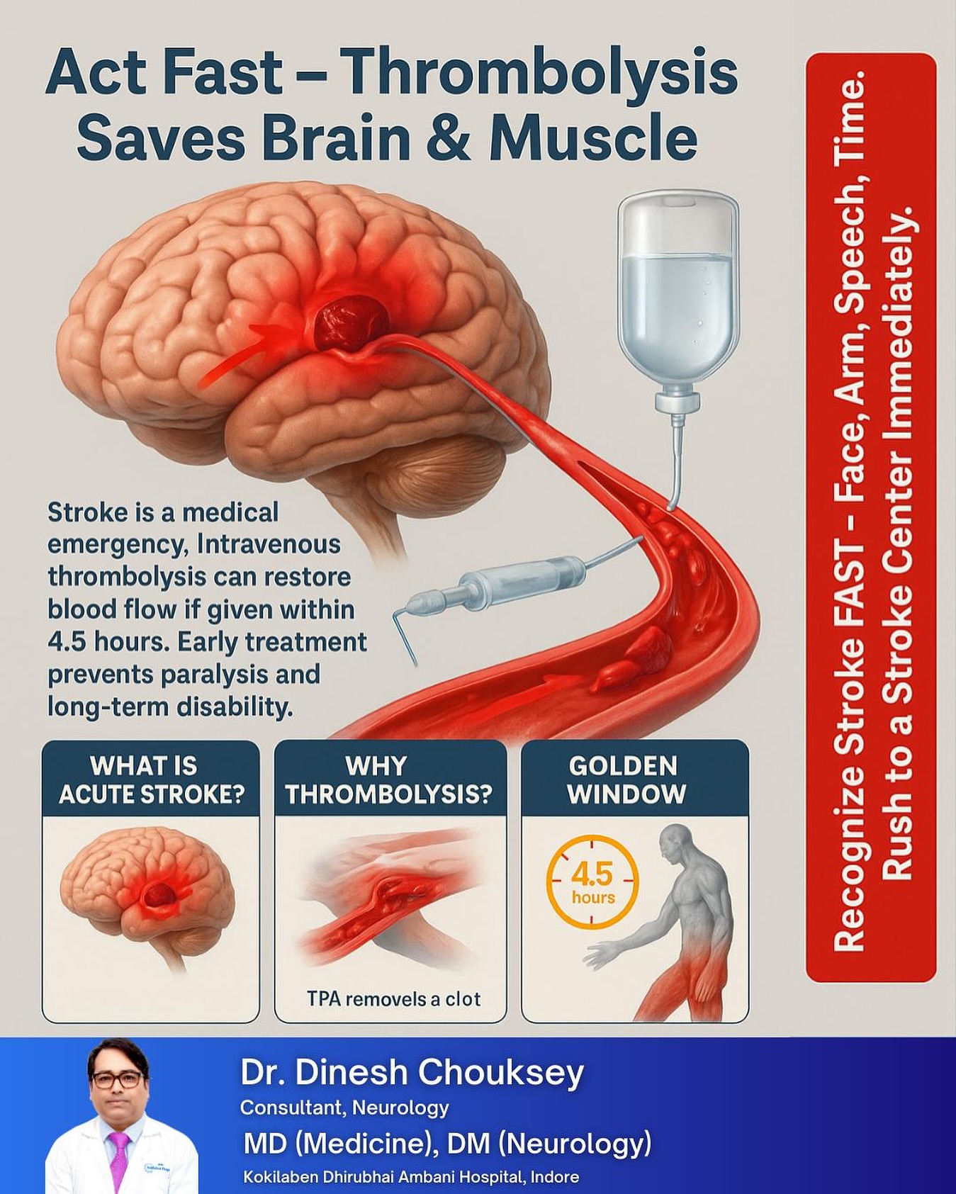 🧠 Act Fast – Save Lives! 🧠 A... - Dr Dinesh Chouksey Neuro | Facebook