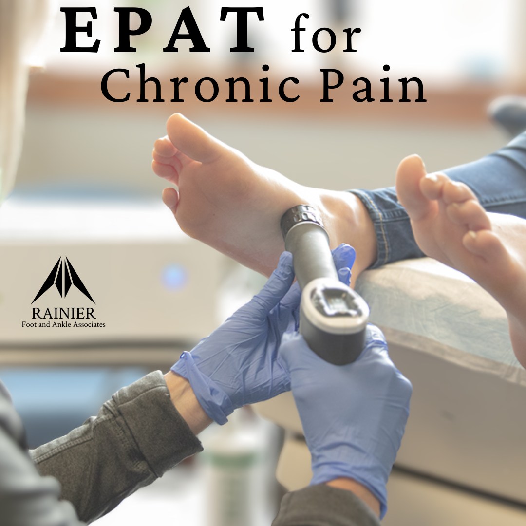 Rainier - Dealing with long-term plantar fasciitis, Achilles pain, or ...