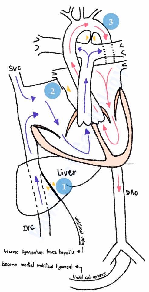 Ep.002 Neonatal circulation (Part 1)... - Brief Cardiology | Facebook