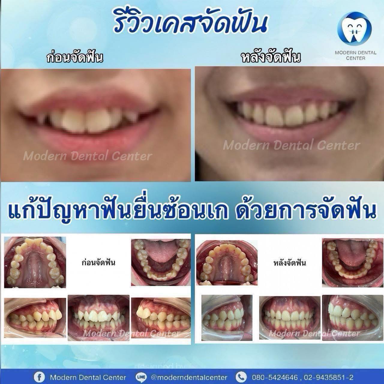 ?media_id=1273543727893860