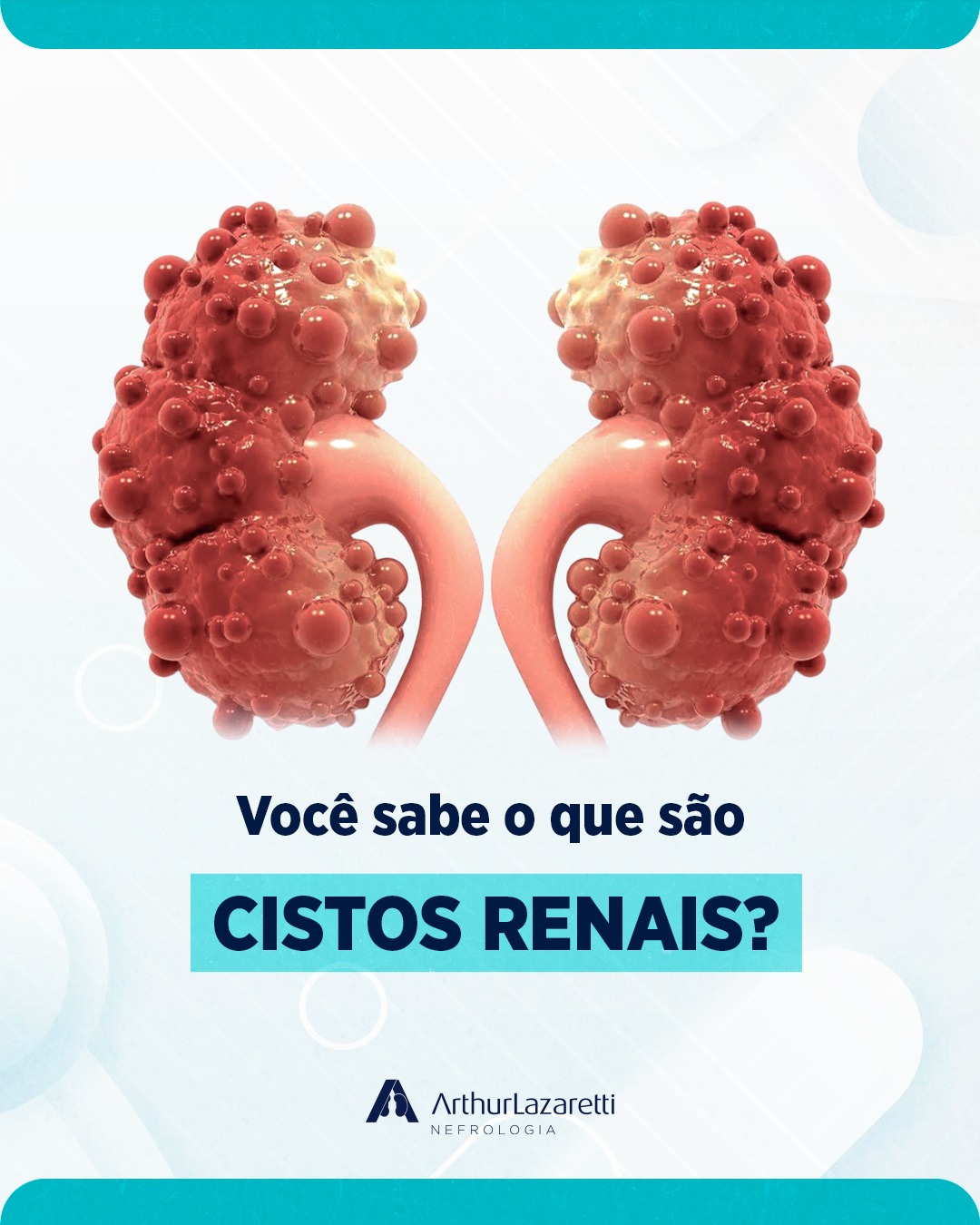 Dr. - Cistos renais são pequenas bolsas cheias de líquido que se formam ...