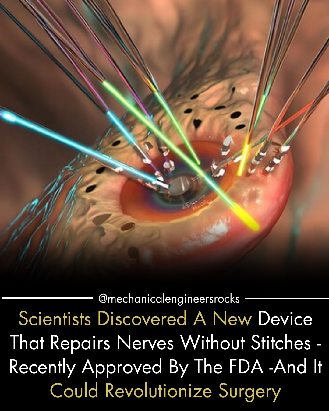 A breakthrough in medical... - Mechanical Engineers Rocks. | Facebook