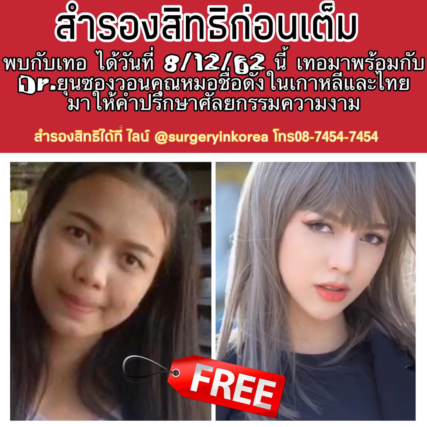 ปรึกษา ฟรี!!! รีวิวศัลยกรรมจมูก คุณหมอ... - Surgery in korea | Facebook
