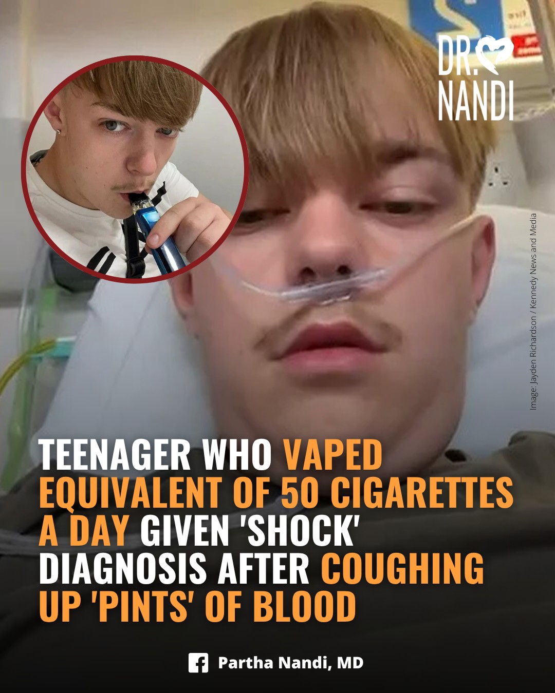 jayden richardson vape Teenager Who Vaped Equivalent of 50 Cigarettes a Day Given 'Shock'  Diagnosis After Coughing up 'Pints' of Blood