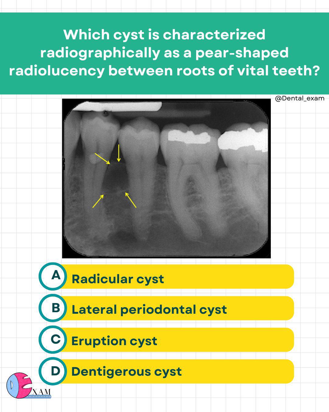 Dental - Comment below ⬇️ | Facebook