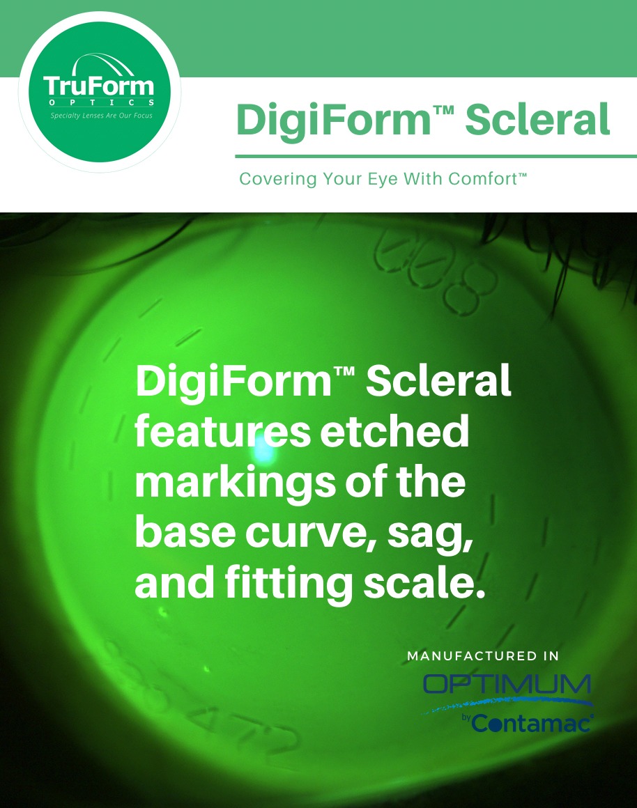 TruForm Optics - The therapeutic use of DigiForm™ Scleral... | Facebook
