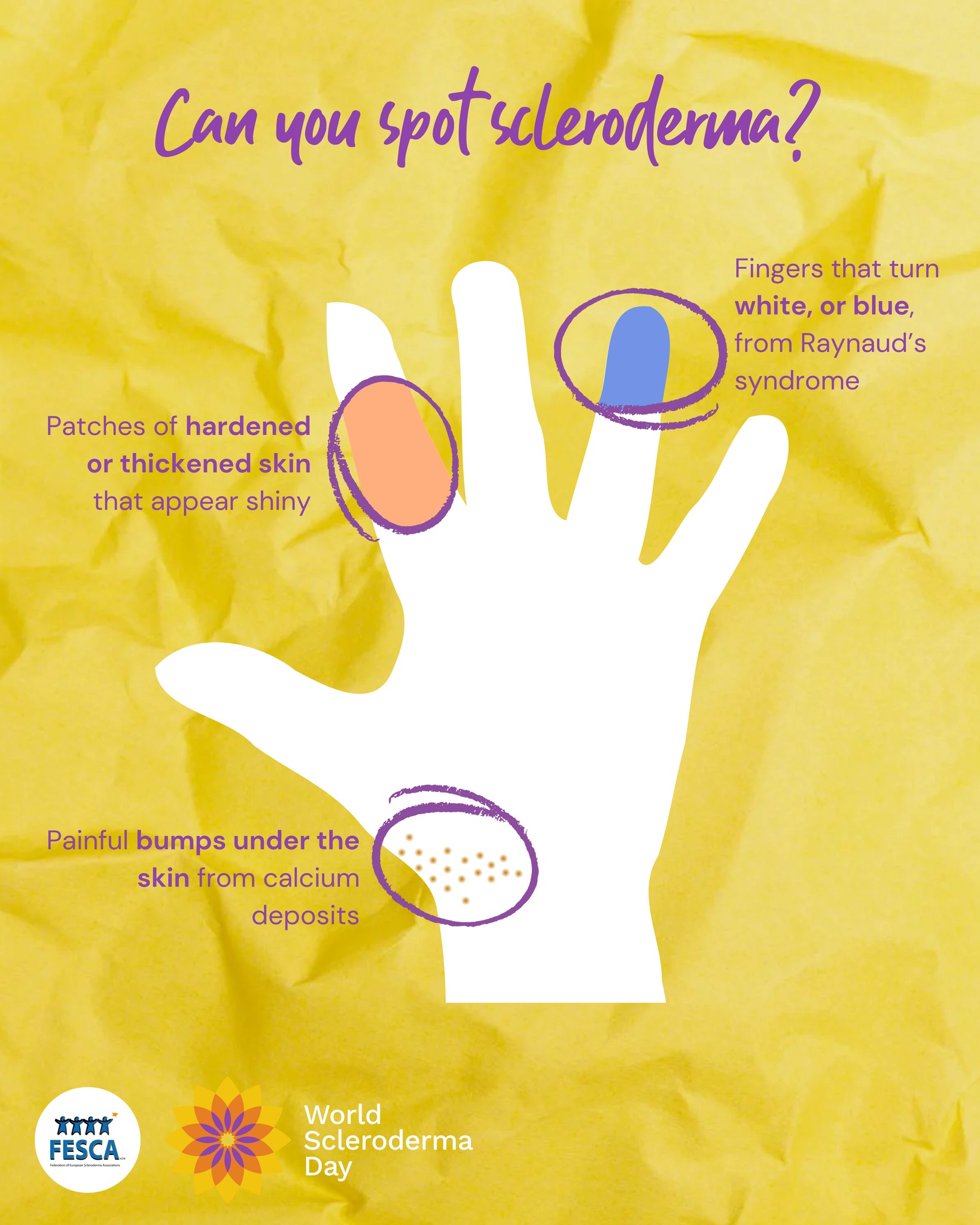 O... - Fesca - Federation of European Scleroderma Associations | Facebook