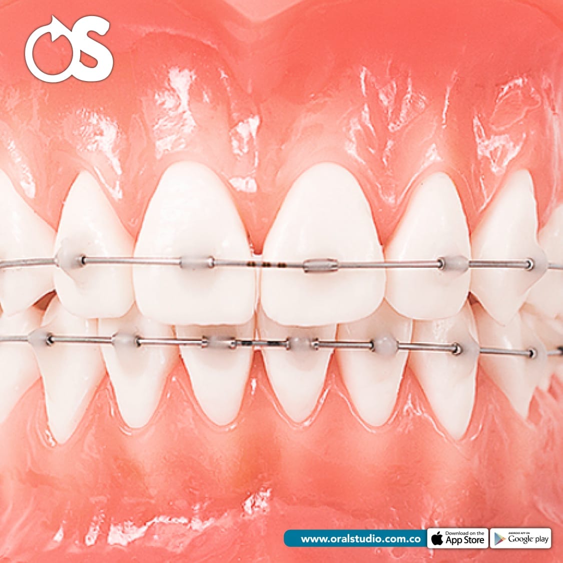 Los Flow Jack son un... - Oralstudio By Jóse Fernando Espitia