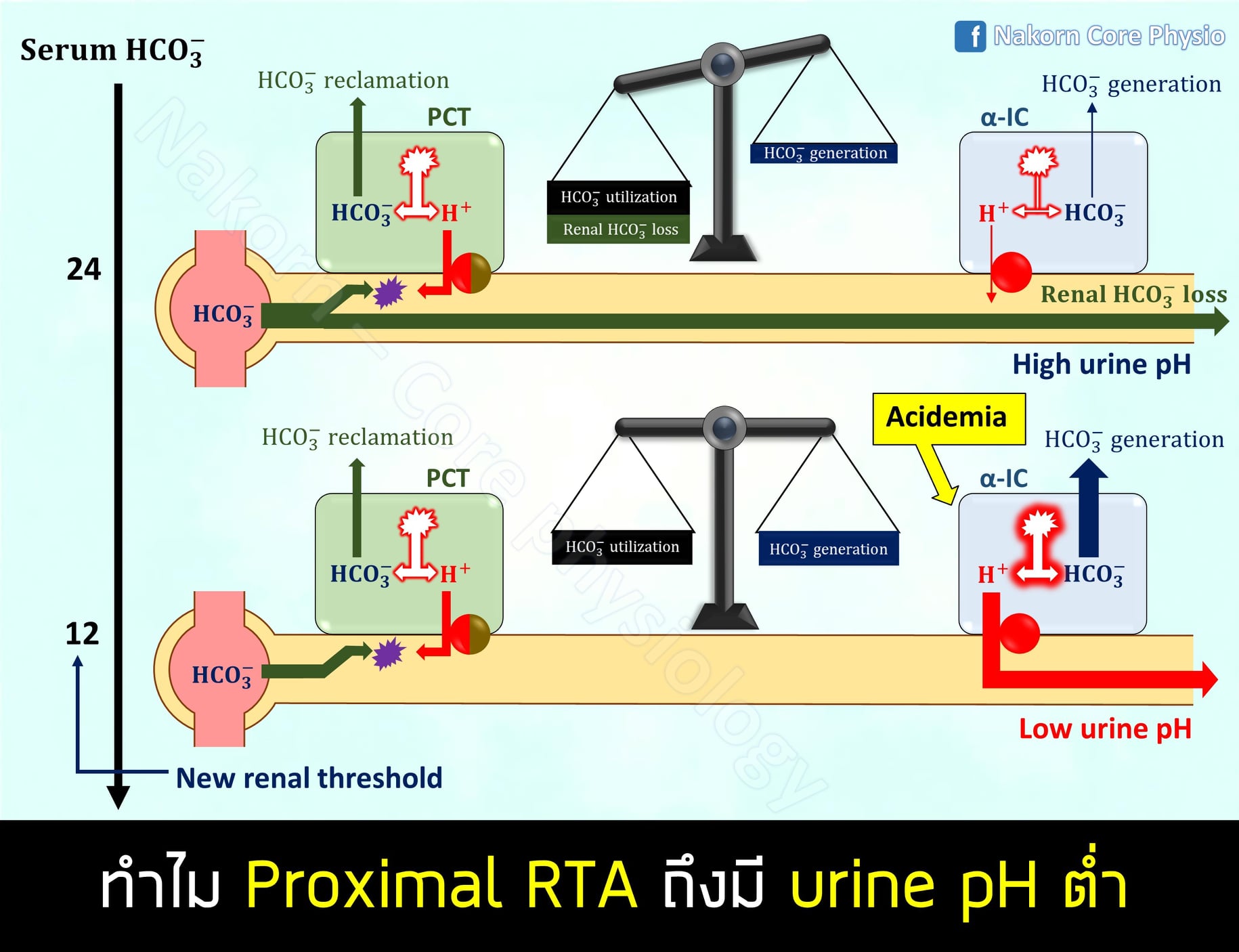 Nakorn - 🙋‍♂️ คำถาม: อ่านเรื่อง Renal tubular acidosis (RTA) มาแล้วงง ...