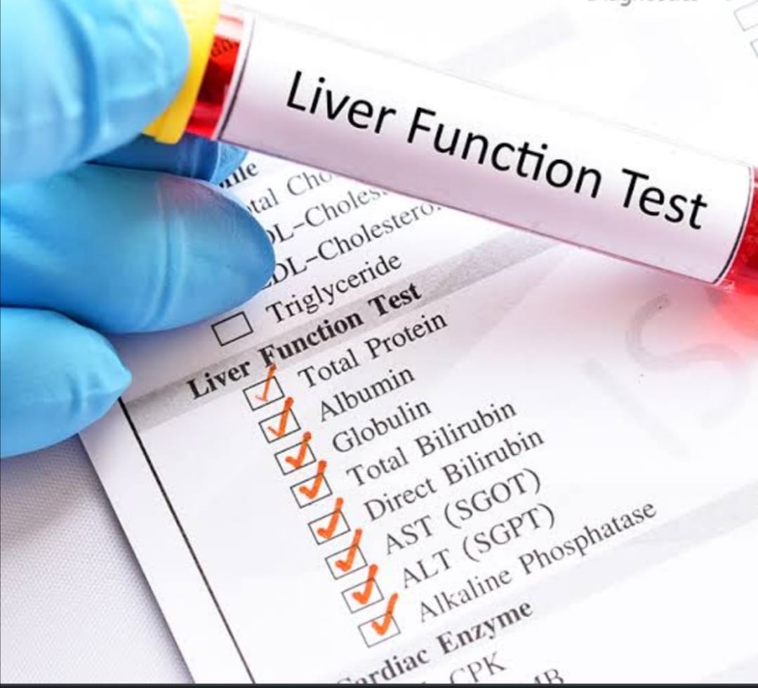Max Lab Jammu - What is Liver Function Test (LFT)? Liver... | Facebook