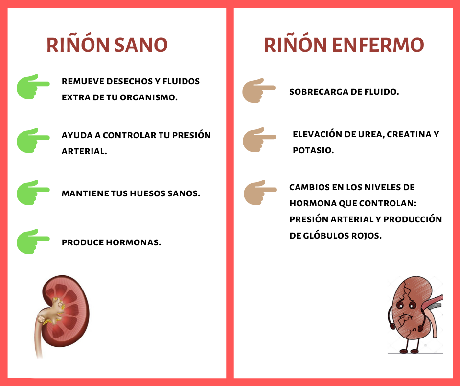 Hemodiálisis - ¿Conoces las diferencias entre un riñón sano y uno ...