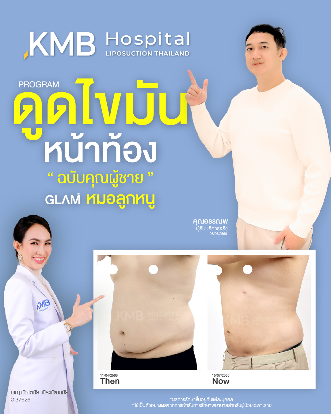 KMB - 𝙐𝙥𝙙𝙖𝙩𝙚 🥰 ผลลัพธ์ โปรแกรม #ดูดไขมันหน้าท้อง ʀᴇᴠɪᴇᴡ จากเคสจริง ที่ ...