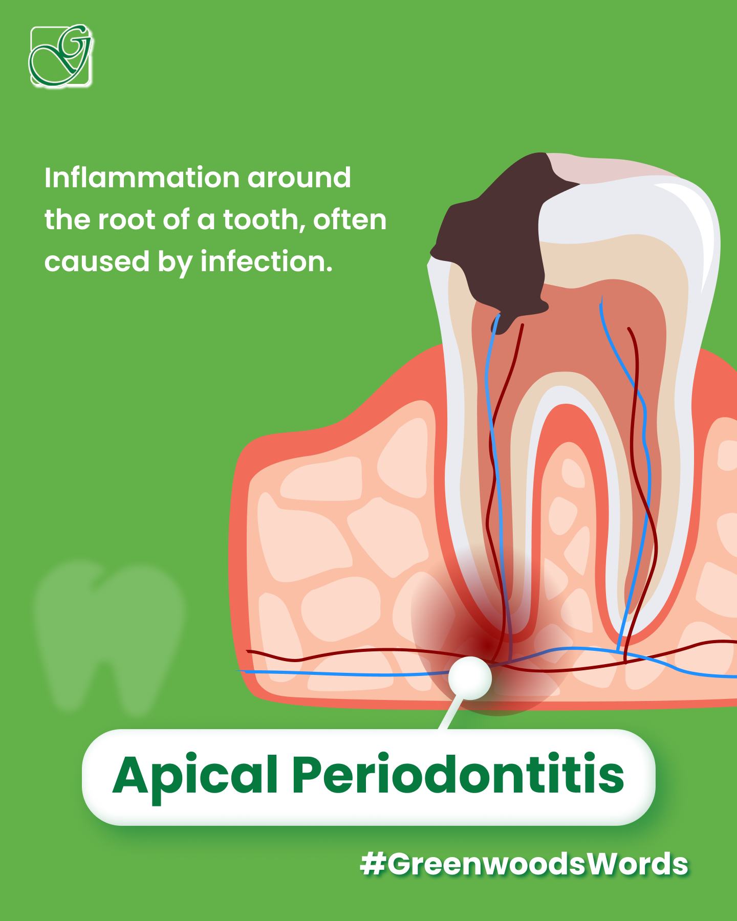 Greenwoods - Understanding the Terminology: Apical Periodontitis Apical ...