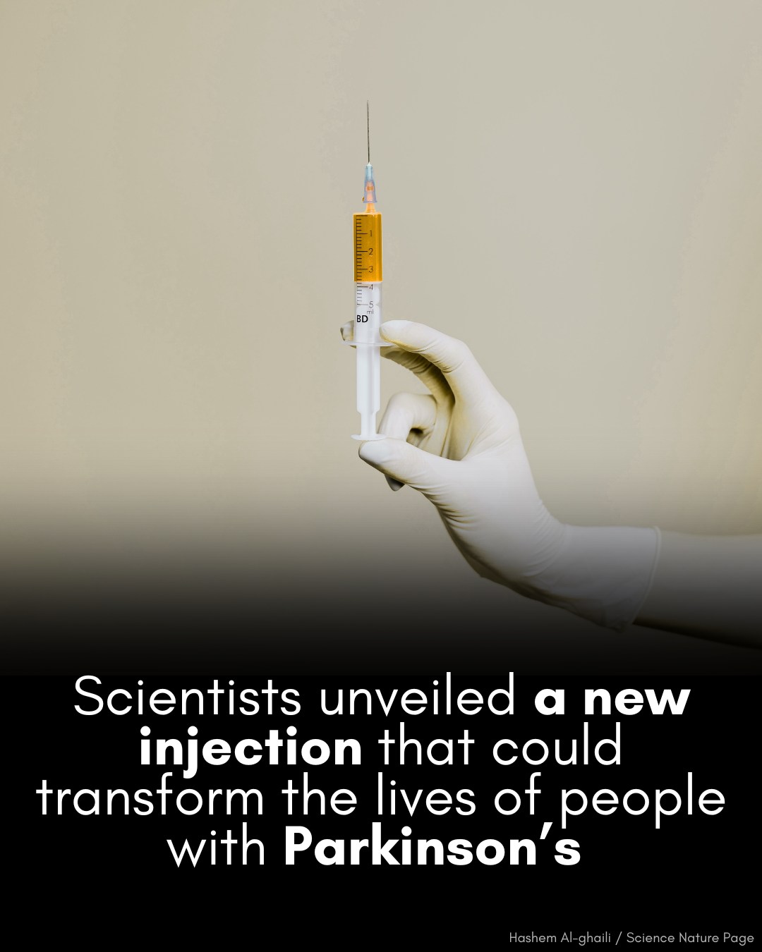 glutathione iv for parkinsons Our study unlocked the most significant Parkinson's breakthrough in 50 years. See how this progress brings real hope forward regenerationsstack BPC-157 vs TB-500: Key Please Select: Box Only/ Push Set:Push Set w/ Vit C