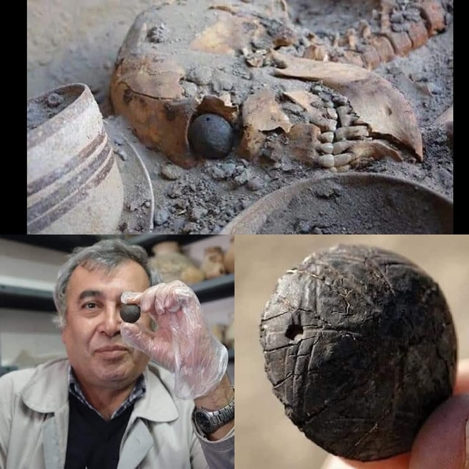 🔍 The World's Oldest Prosthetic Eye – A Glimpse into Ancient