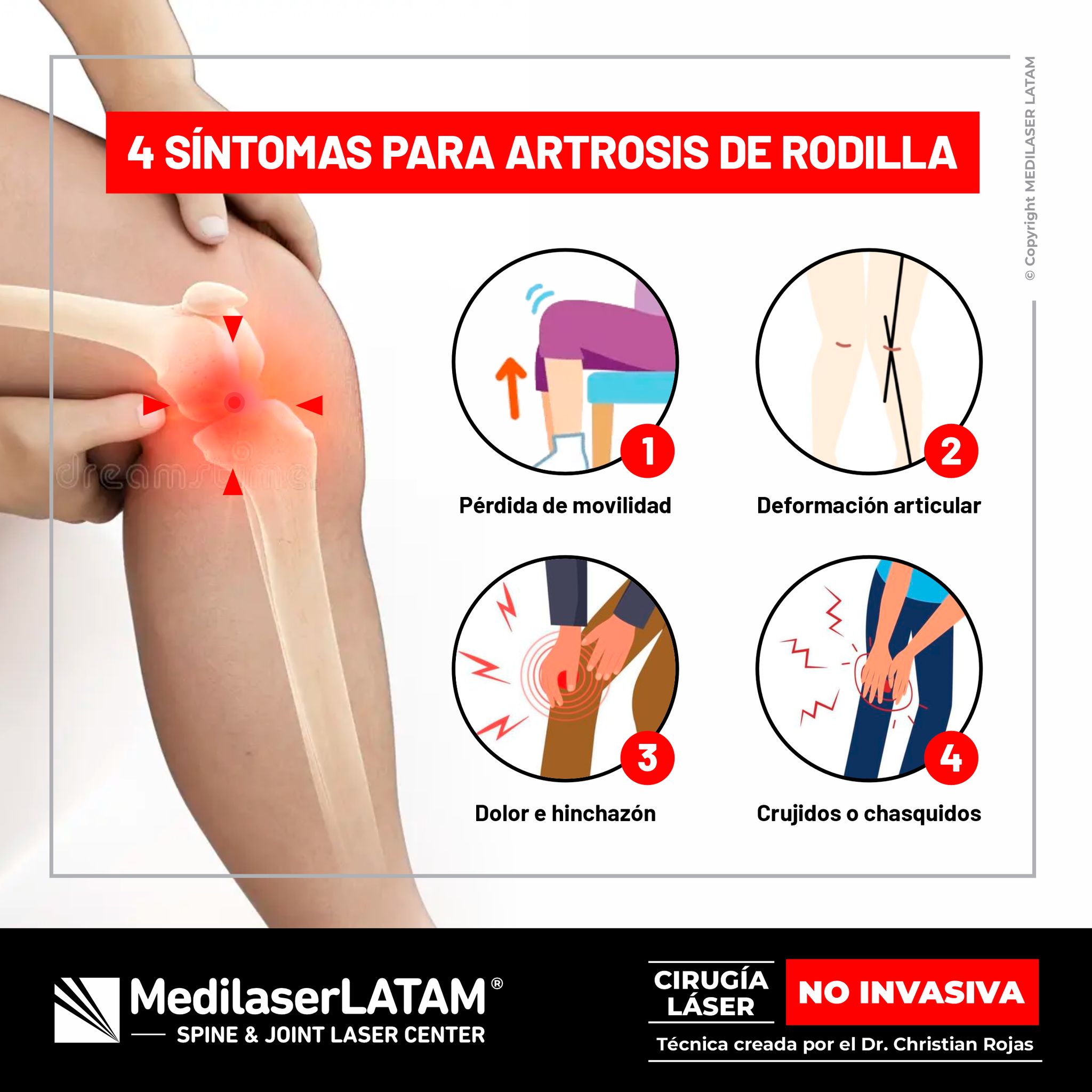 Medilaser - El tratamiento convencional para pacientes con cuadros ...