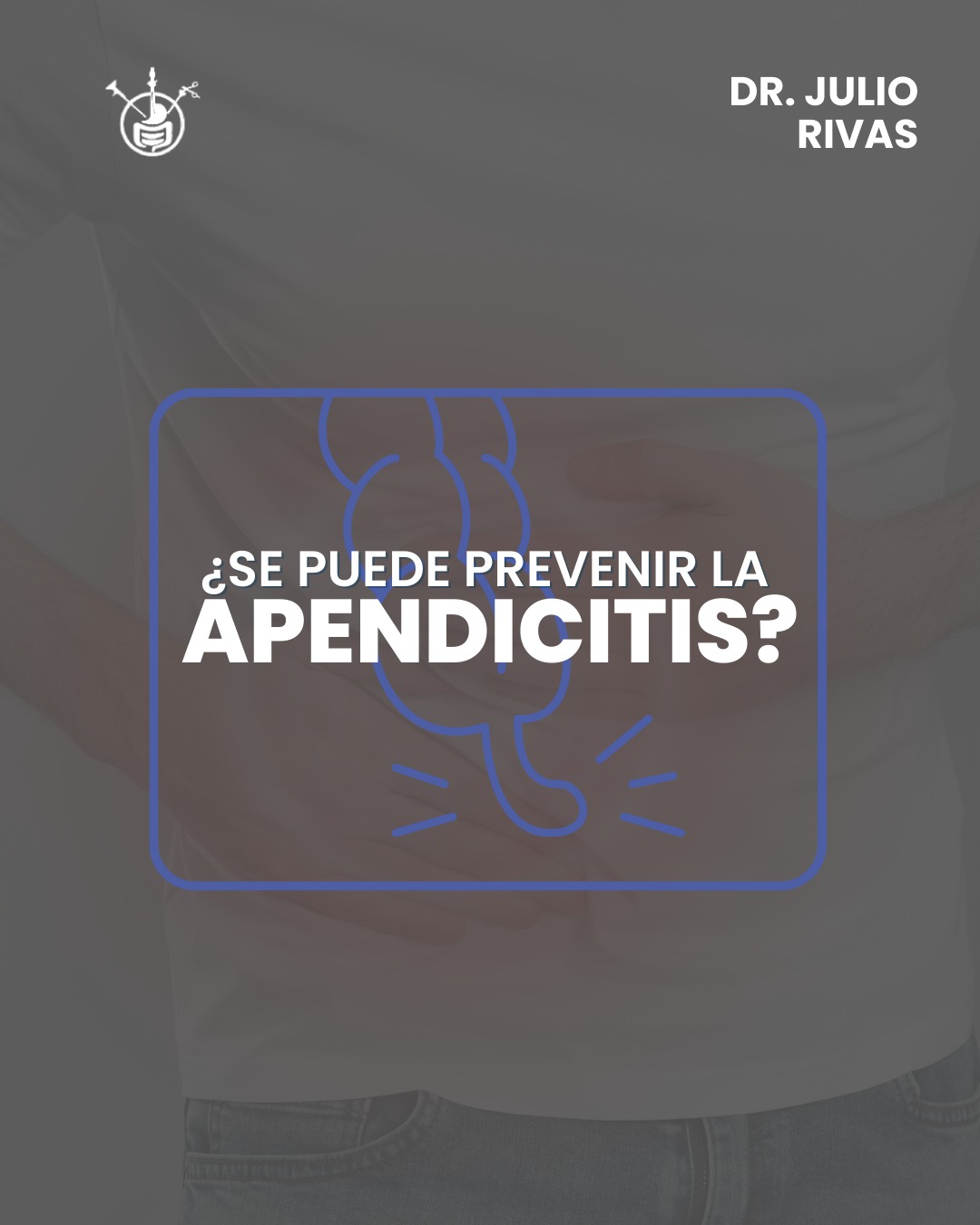 Dr. Julio Rivas - ¿Se puede prevenir una apendicitis?... | Facebook