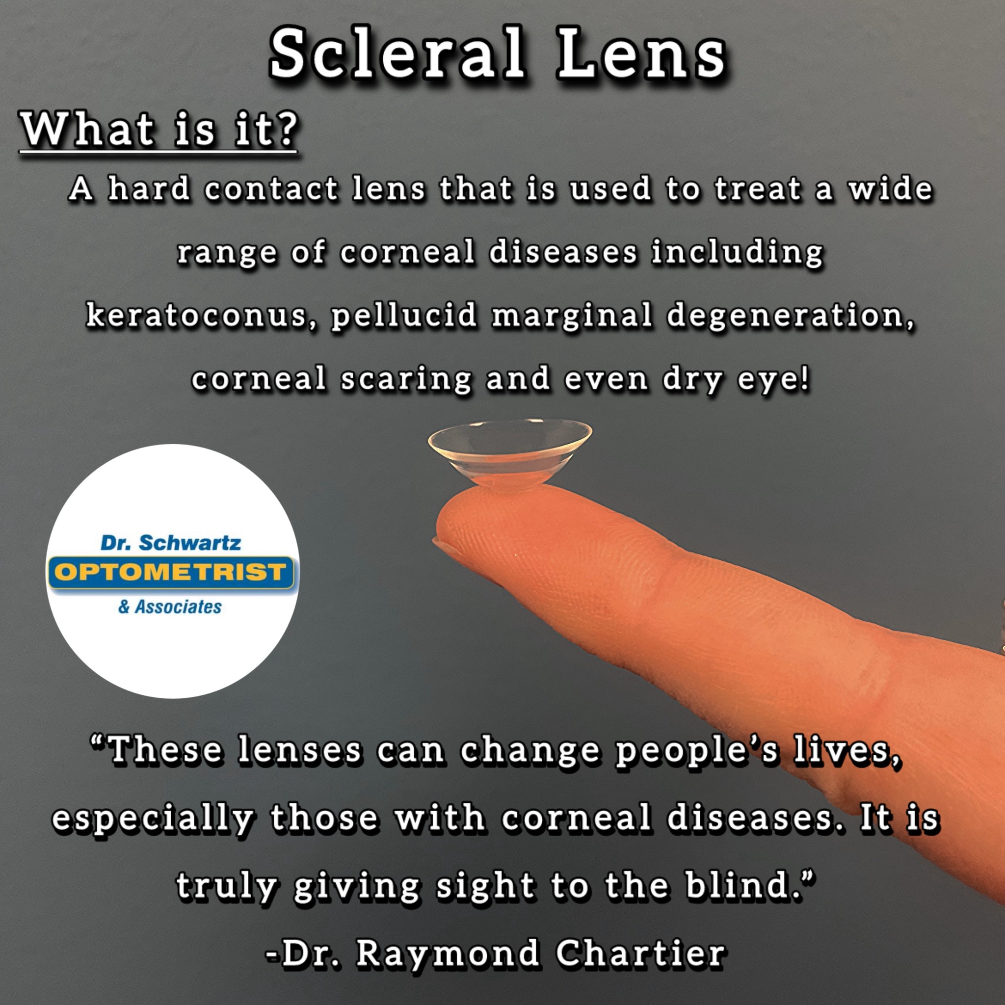 Dr. Schwartz Optometrist and Associates - Why a black eye is called a ...