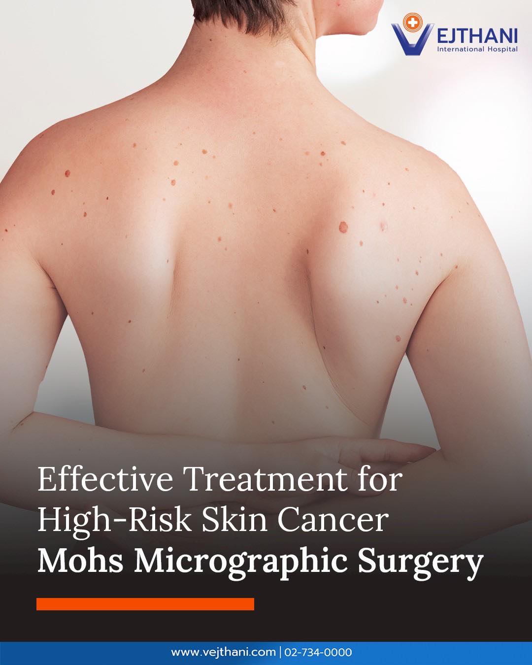Vejthani - Mohs Micrographic Surgery: An Effective Treatment for High ...