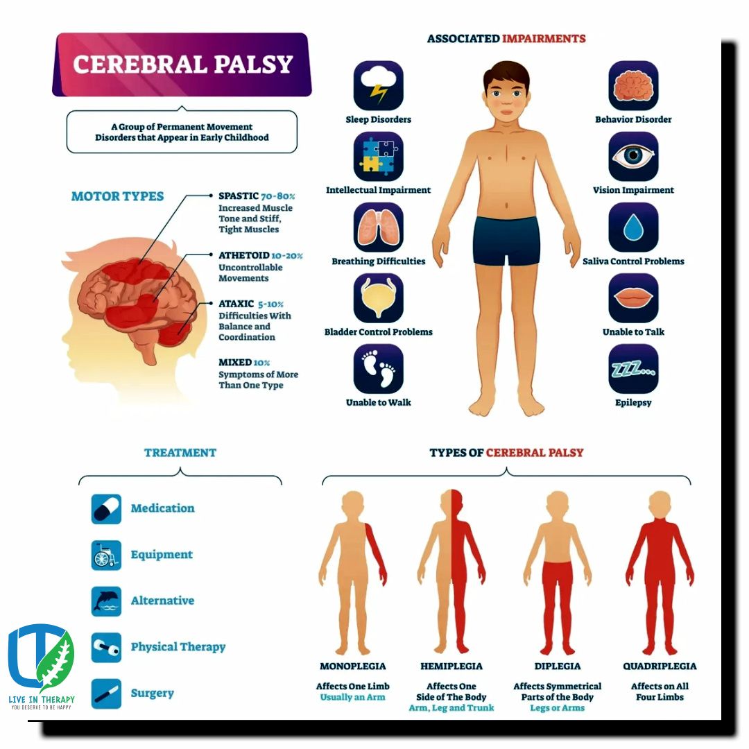 Nasir - Cerebral Palsy, or CP, is a condition that affects a child’s ...