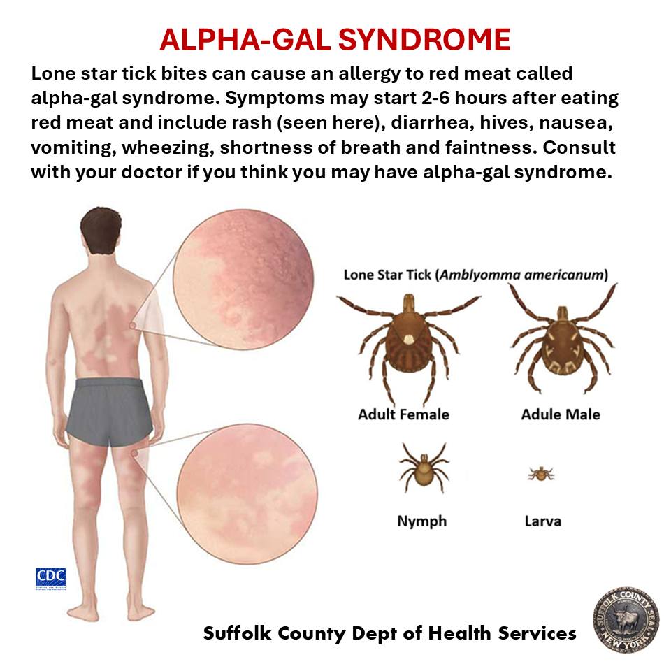 Image showcasing Suffolk County Health | Great River NY