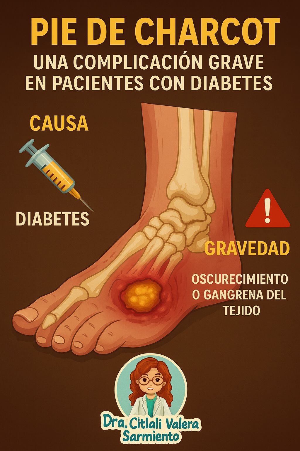 Dra. - ⚠️ PIE DE CHARCOT: UNA COMPLICACIÓN GRAVE DE LA DIABETES ⚠️ El