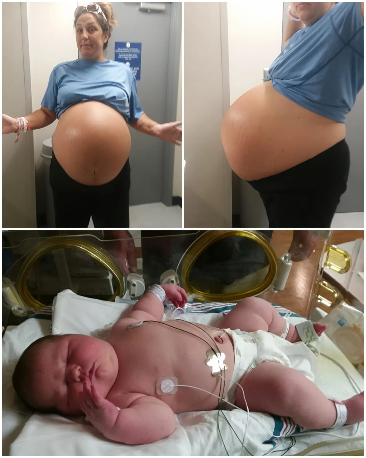 Brazilian Mother Welcomes 12lb 6oz Baby, Breaking 27-Year Hospital