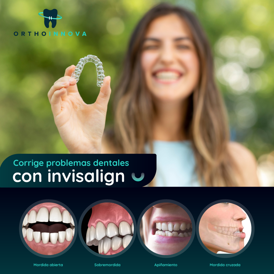 OrthoInnova - Sabías que Invisalign puede ser utilizado...