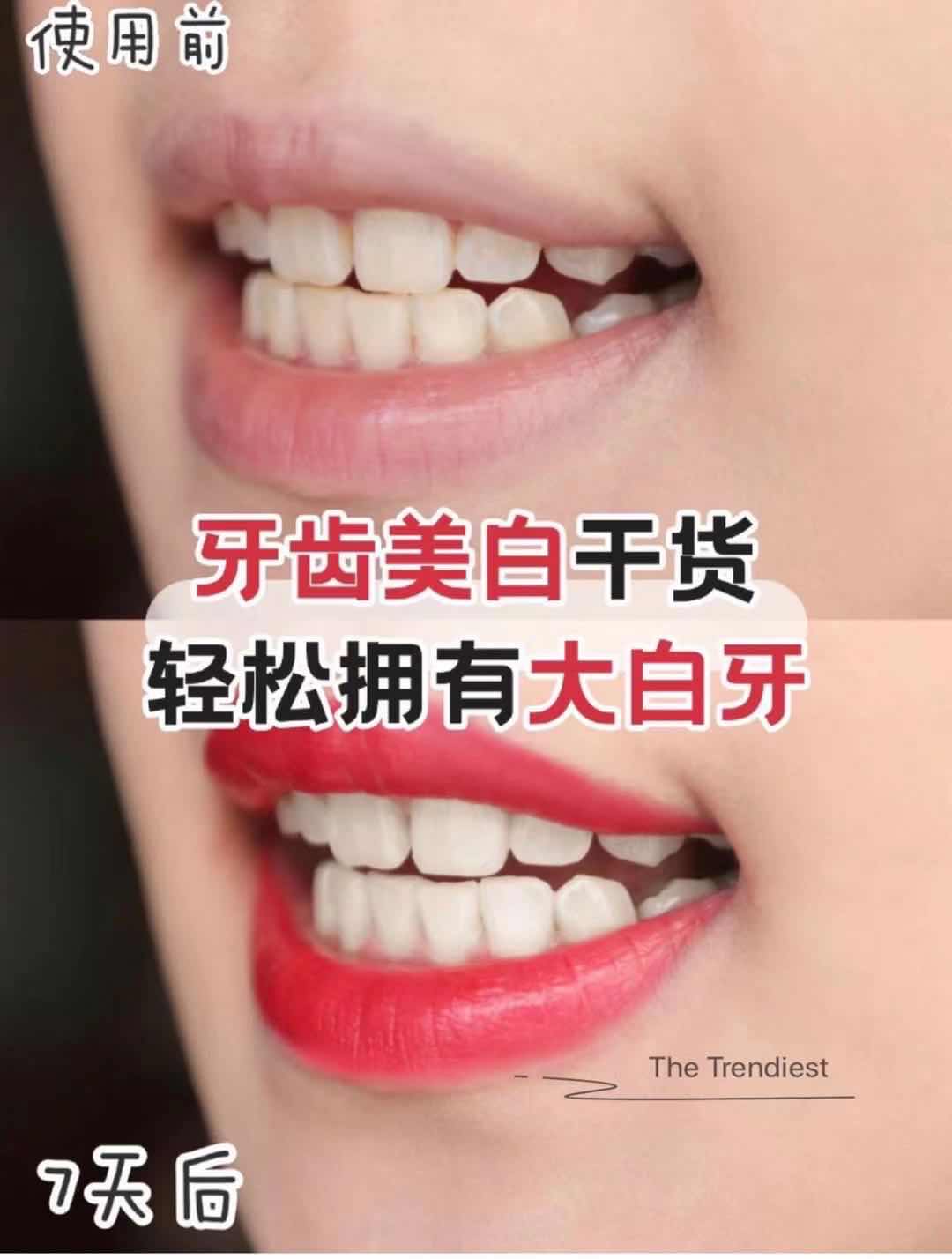 每个星期的牙齿美白护理 告别小黄牙 咖啡迹 茶迹 达到美白效果 The Trendiest 海外代购 Facebook