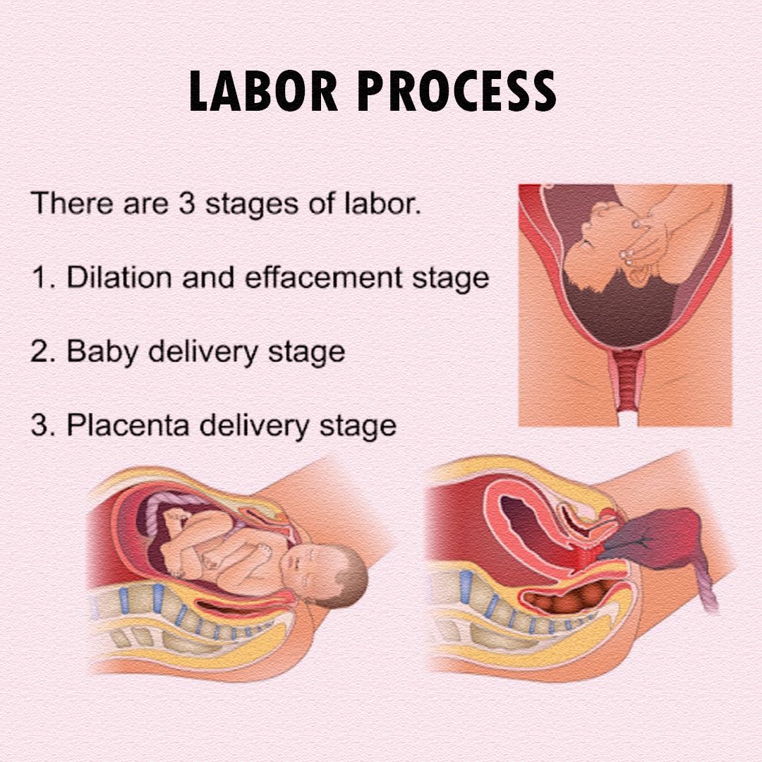 Pregnancy - 👶 PROCESS OF LABOR (Simple Guide) 🔹 1. Early Labor • Cervix ...