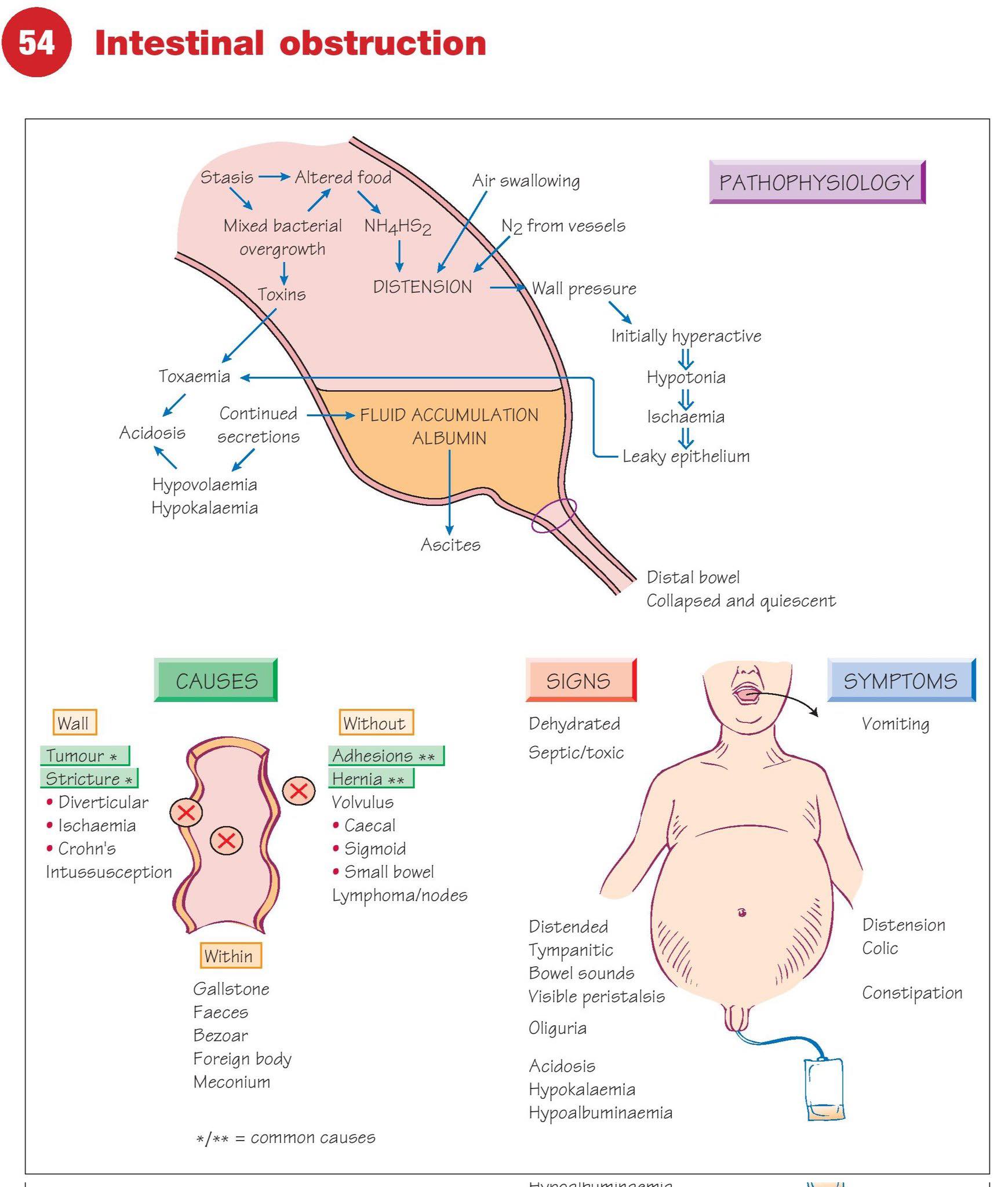Cardiophilia - A detailed diagram and explanation of Intestinal ...