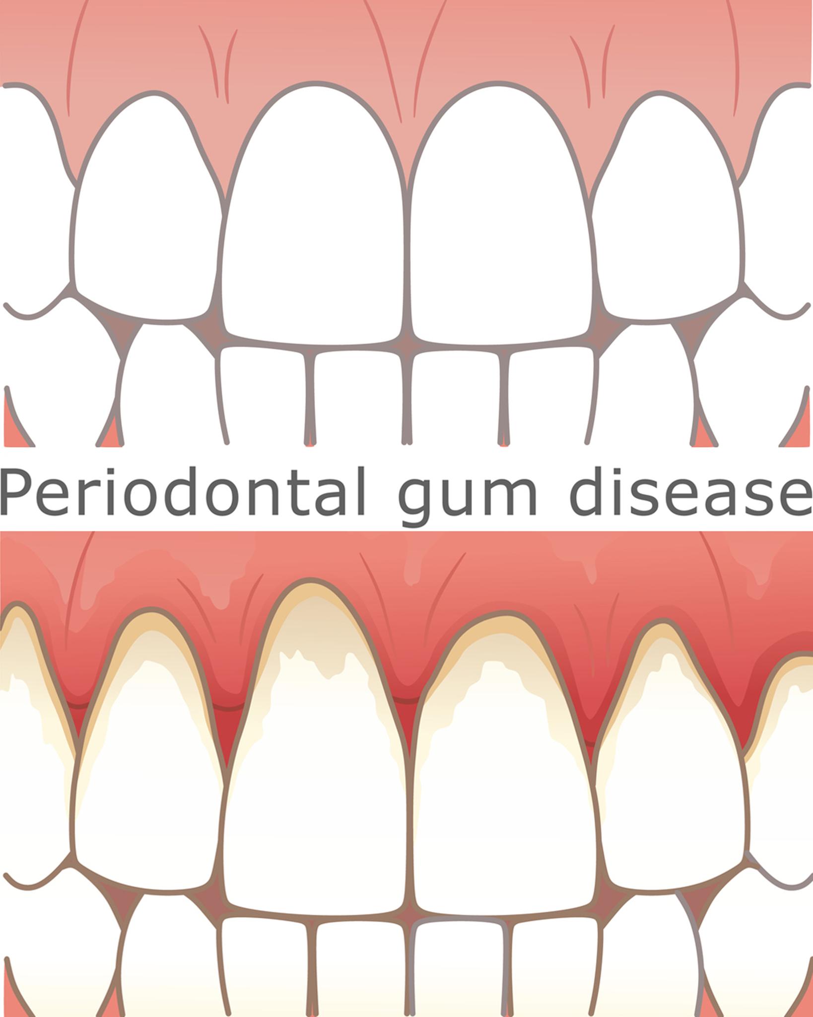The Wagner - Periodontal patients are always welcome at The Wagner ...