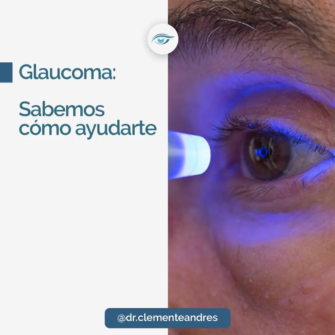 👁 ¿QUÉ ES EL GLAUCOMA? 👉 El... - Dr. Andres Clemente | Facebook
