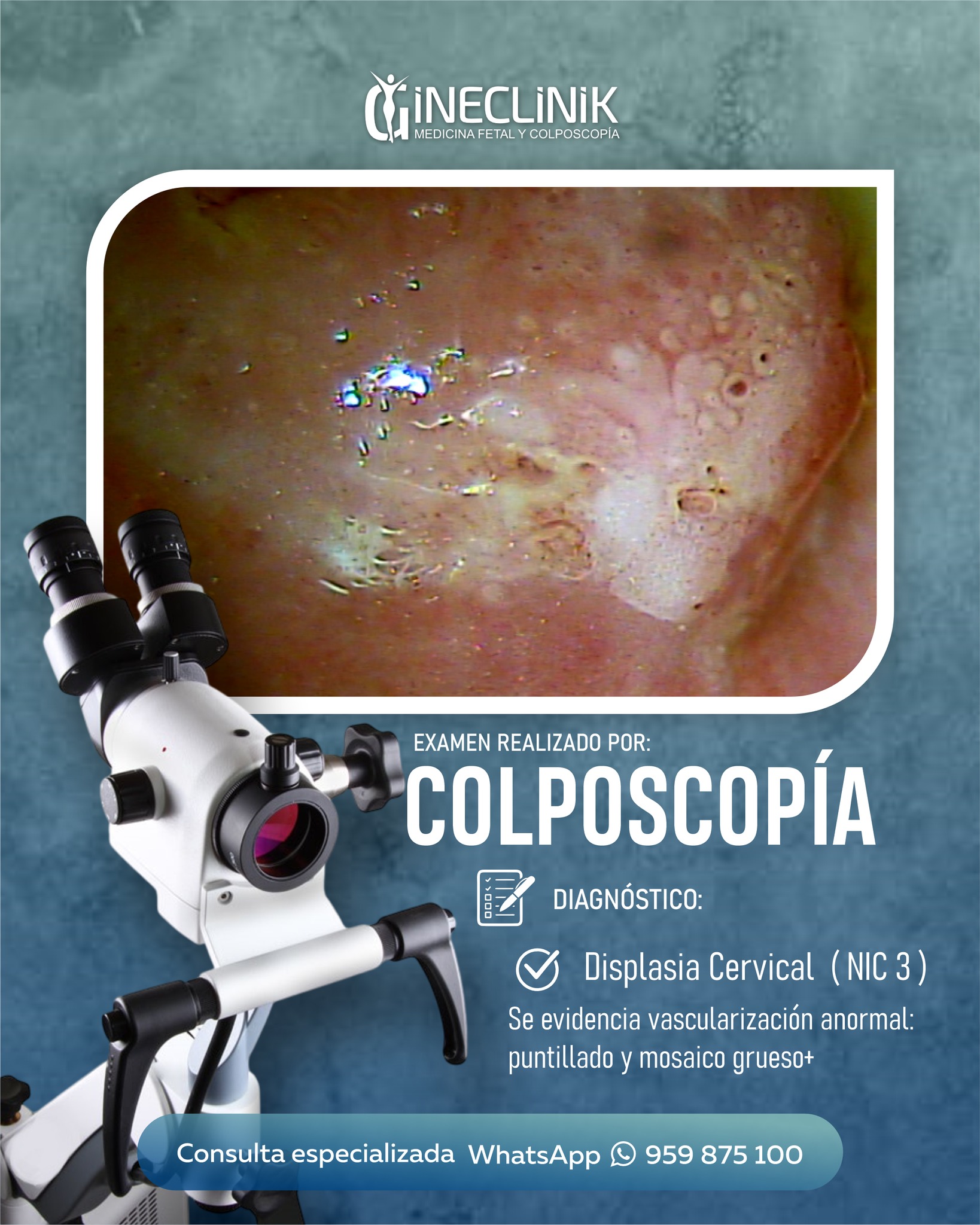 Gineclinik - 👩‍⚕️ Colposcopia: Una Herramienta Clave para la Salud ...