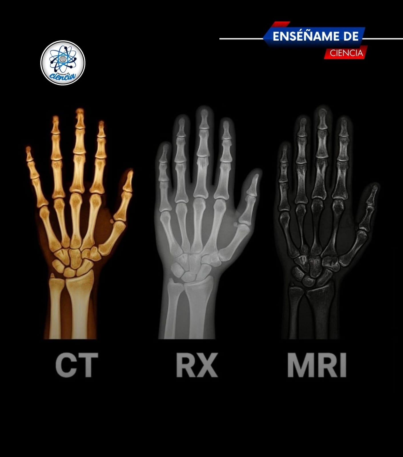 Enséñame - Presta atención 👀 👇🏼 🩻 CT (Tomografía computarizada) Permite ...