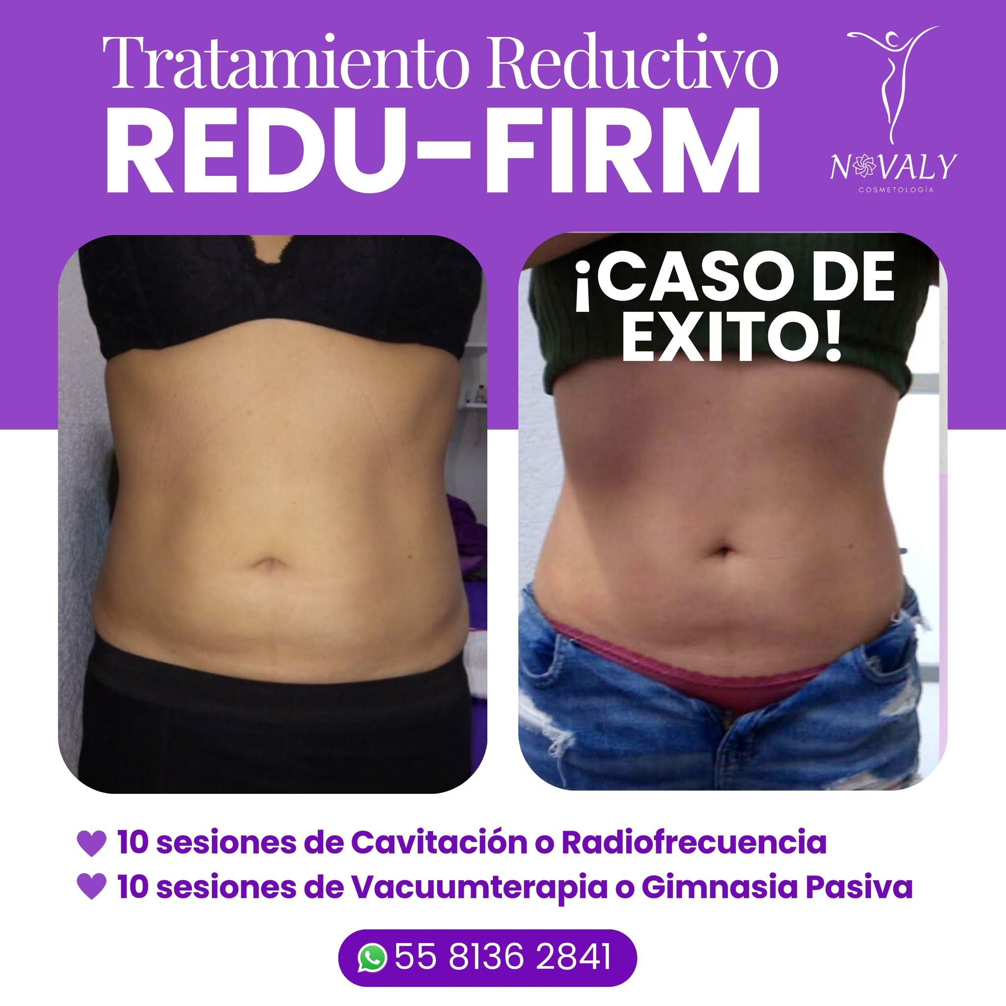 Novaly - 💥 ¡DALE UN GIRO A TU FIGURA CON REDU-FIRM! 💥 ¿Lista para ...
