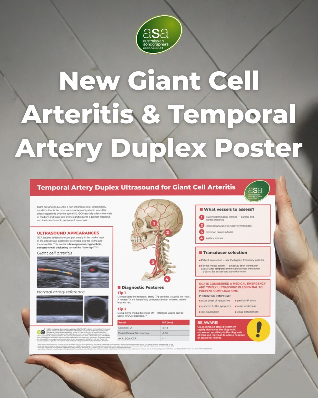 Australasian - Giant cell arteritis is a medical emergency, and early ...