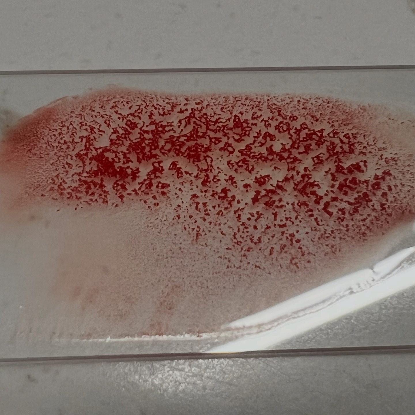 Critical - Saline Agglutination Test (SAT): simple, fast, and very easy ...