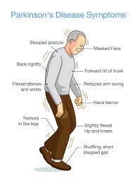 glp 1 parkinson's disease Incretin and insulin signaling as novel therapeutic targets for Alzheimer's and GLP-1 and Parkinson's Disease: Research,