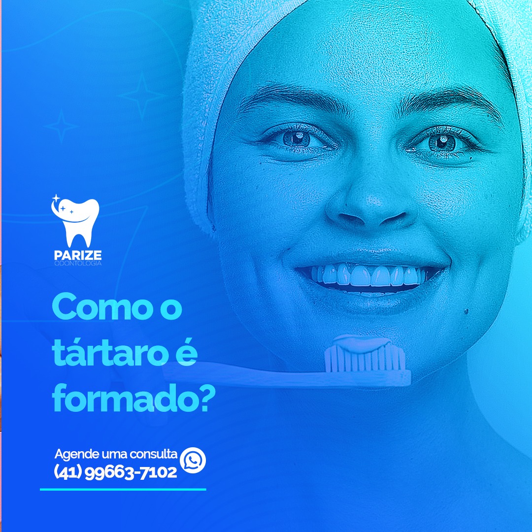O tártaro é o... - Parize Odontologia - Boqueirão - Curitiba