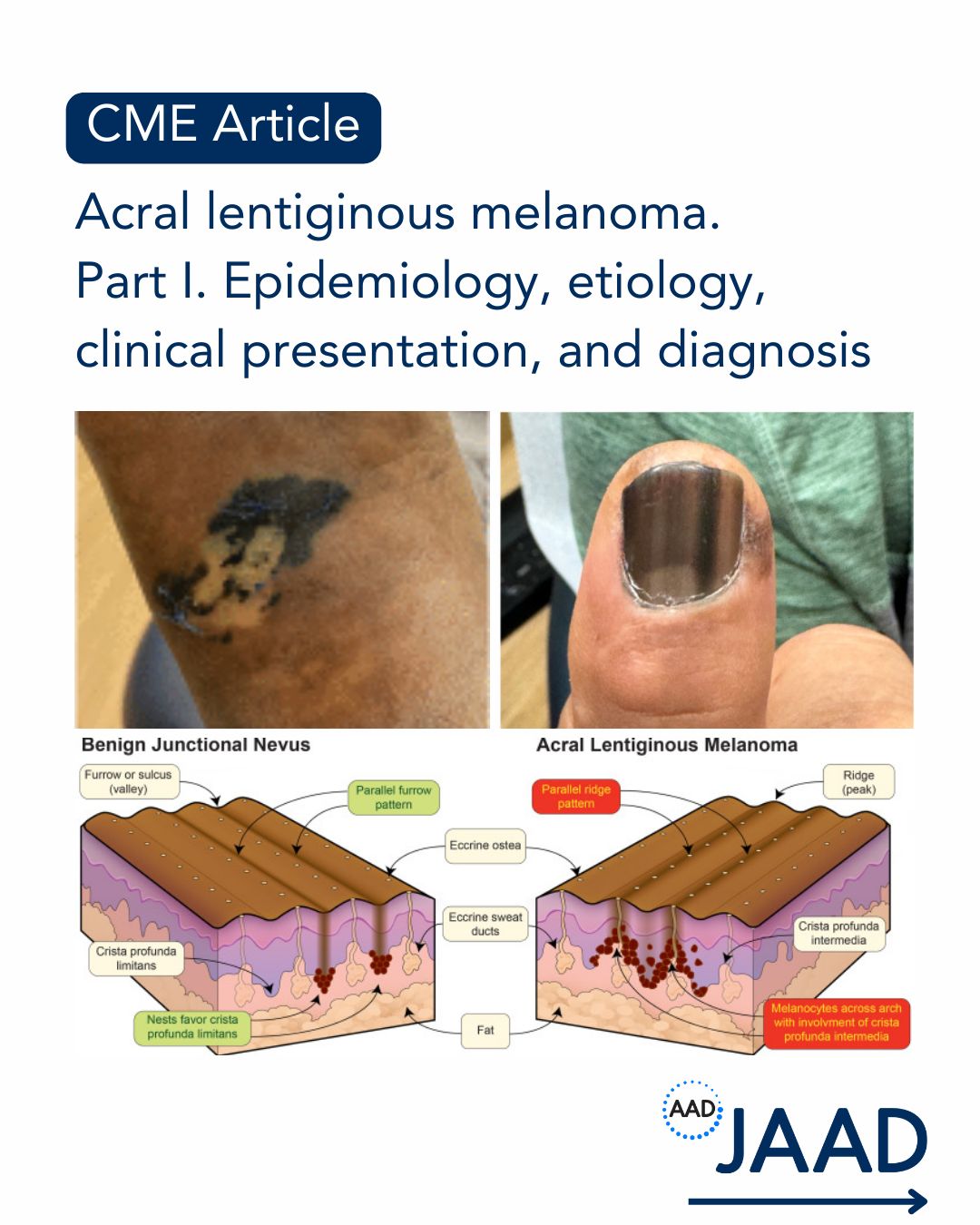 HELLO - [ APPROACH TO Retiform Purpura ] 🦠🦠🦠🦠🦠🦠🦠🦠🦠🦠🦠🦠 หากพบเจอ #ผื่น ...