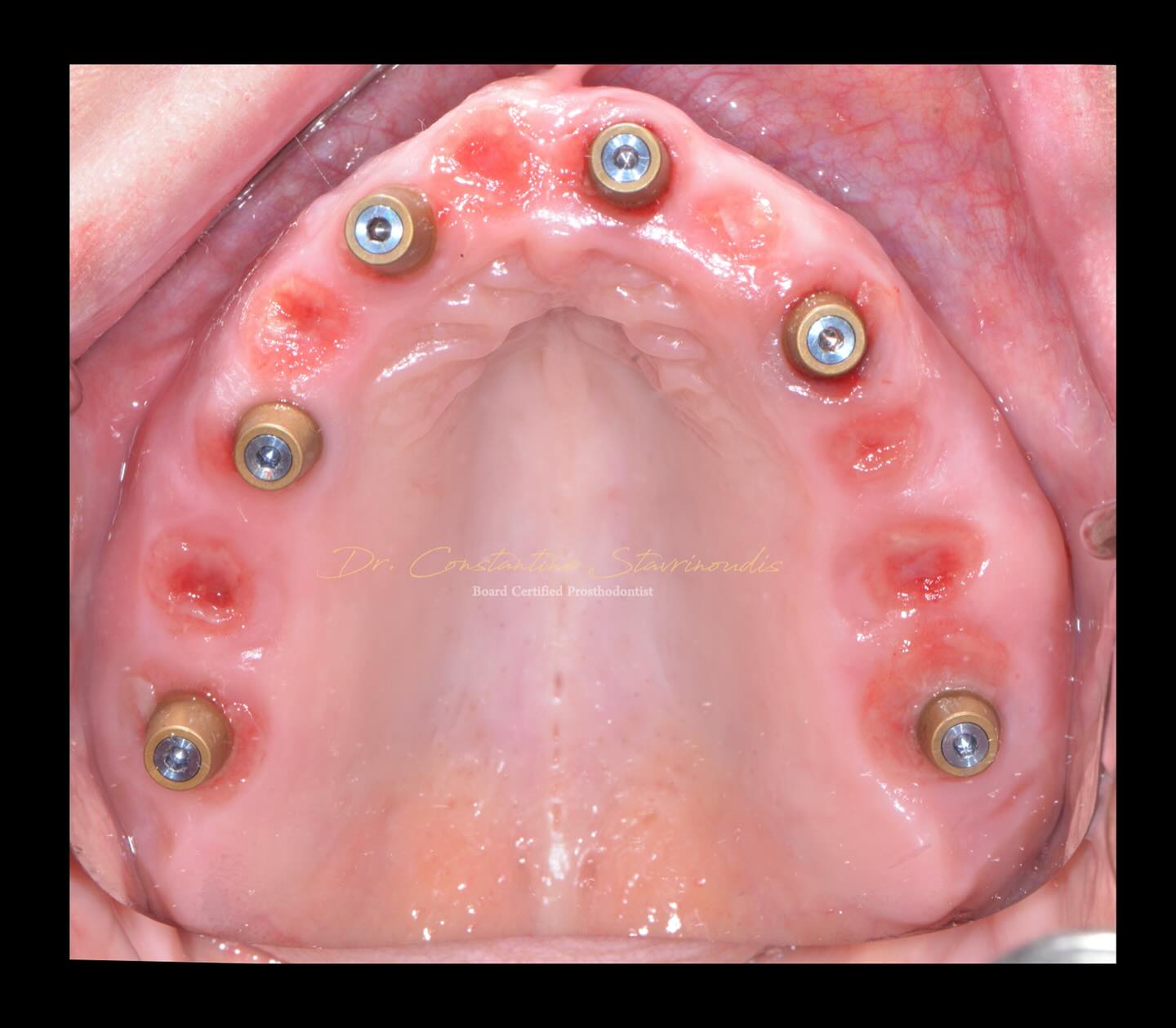 Dr. Constantine... - Dr. Constantine Stavrinoudis DDS, FACP
