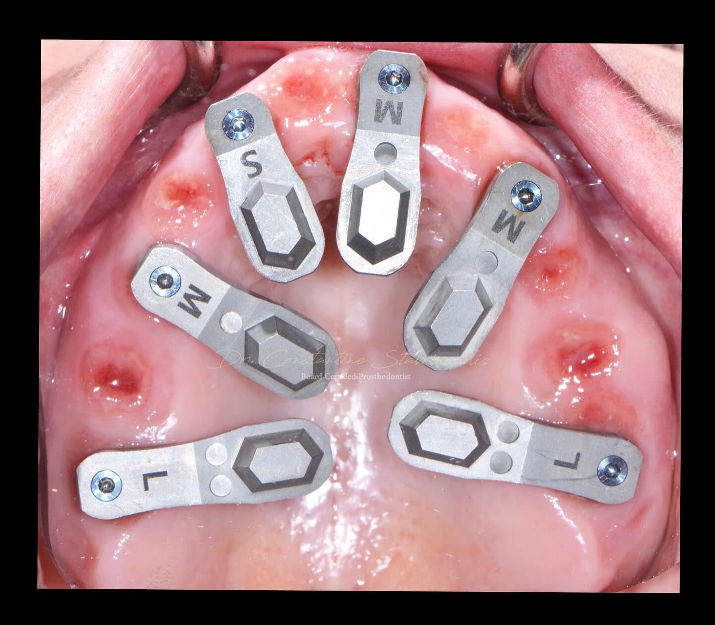 Dr. Constantine... - Dr. Constantine Stavrinoudis DDS, FACP